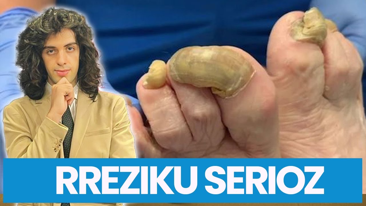 E PABESUESHME! MYKU i THONJVE një tregues SERIOZ për shëndetin tuaj, ja çfarë RREZIKONI