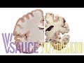 Хвороба Альцгеймера та мозок - Vsauce українською