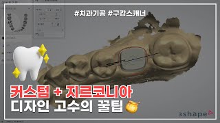 구강스캐너 커스텀 지르코니아 3shape 디자인
