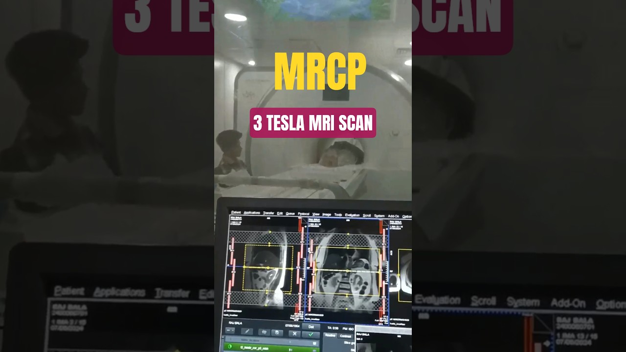 MRCP scan | MRI 3 tesla 