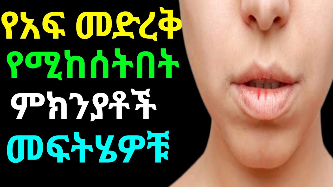 የአፍ መድረቅ የሚከሰትበት ምክንያቶች ፣ ምልክቶቹ እና መፍትሄዎች