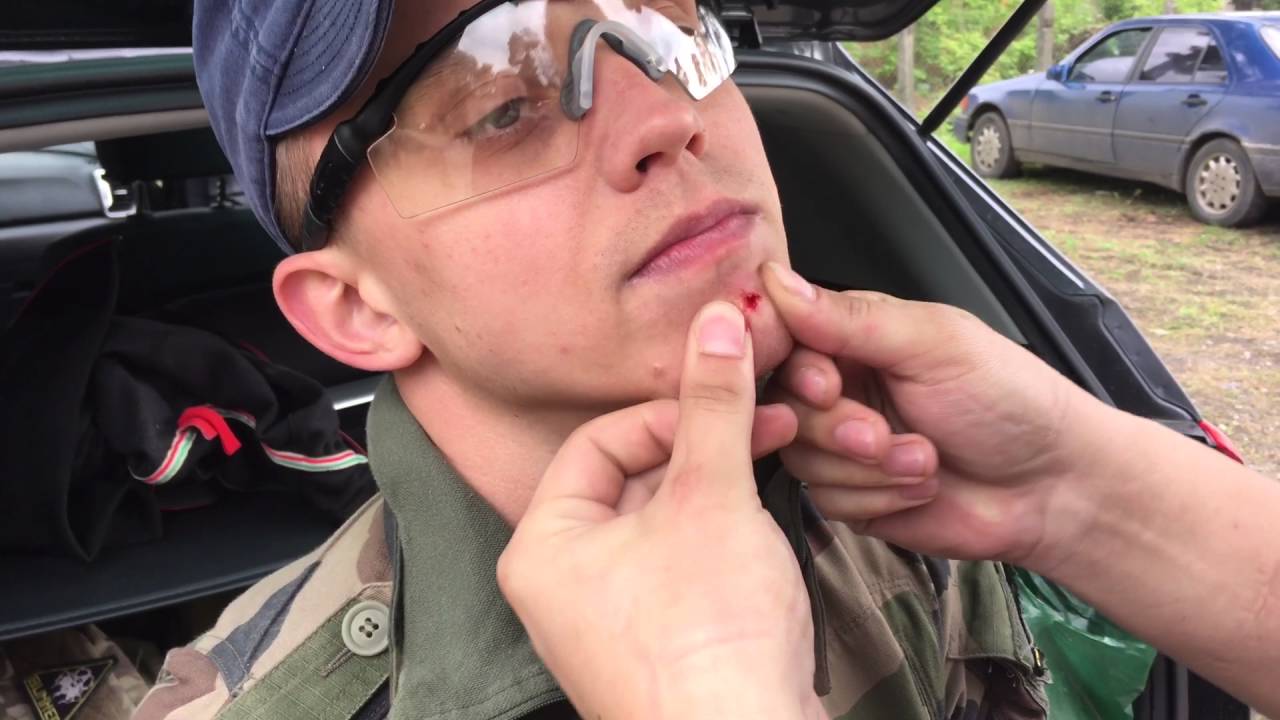 Airsoft injury YouTube