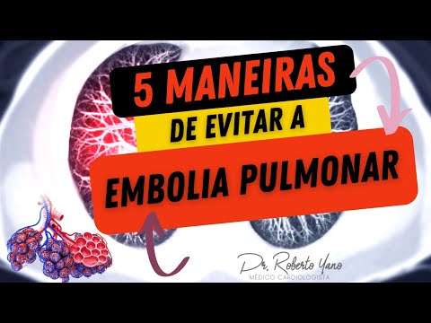 Vídeo: 3 maneiras de prevenir a embolia pulmonar