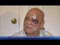 Bronx Man Beaten In His Lobby