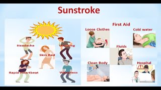Sunstrokeincredible Unknown Facts About Sunstroke Everything You Need To Know About Sunstroke