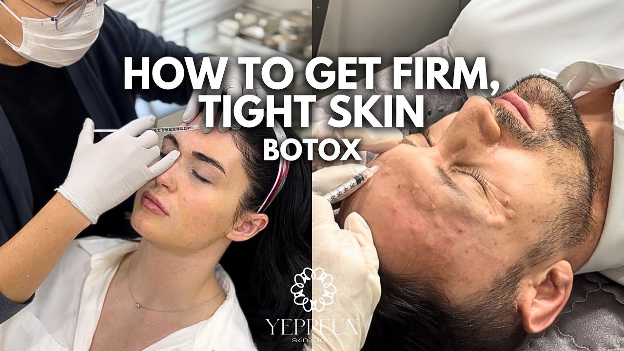 HOW TO GET FIRM, TIGHT SKIN — BOTOX | SKIN CLINIC IN DUBAI 