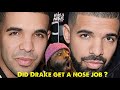 did Drake have a nose job ?