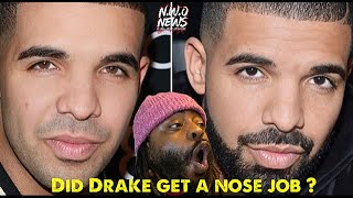 did Drake have a nose job ?