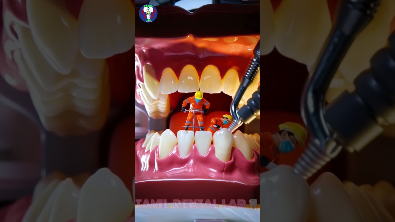 🎯👨🏻‍🎨Art Of Miniature🦷🖌️| 👄🤩Dental Mini World😬⭐| Tamil Dental Lab | 