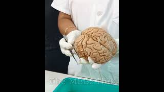 BRAIN DISSECTION  | PARTS OF BRAIN | AREAS OF BRAIN | BRAIN ANATOMY #neet #mbbs #aiims