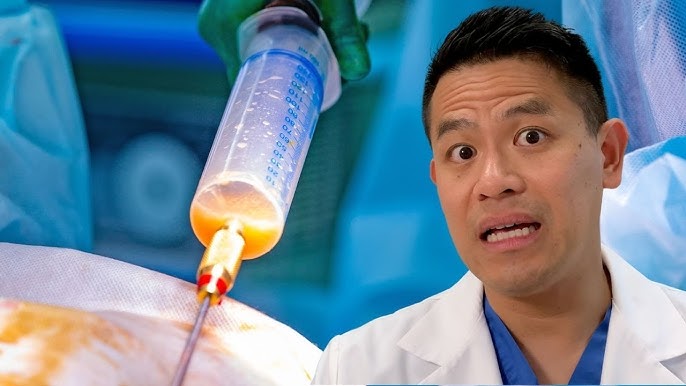 Пенис сақинасын қалай жасауға болады Пенис сақинасын қалай жасауға болады