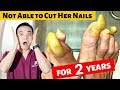 Not Able to Cut her Nails for 2 Years. Short Episode