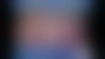 Laparoscopic anatomical segment 7 resection