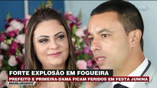 Explosão Em Fogueira Fere Prefeito De Osasco