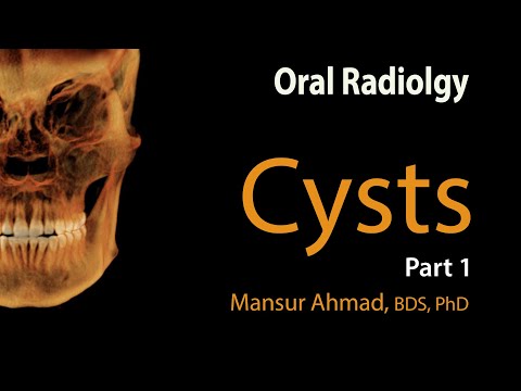 Video: Cyst Mukus: Punca, Gejala, Dan Diagnosis