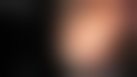 Endoloop-assisted polypectomy