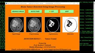 Full Brain Tumor Detection Using Image Processing | Python Project With Source Code Update