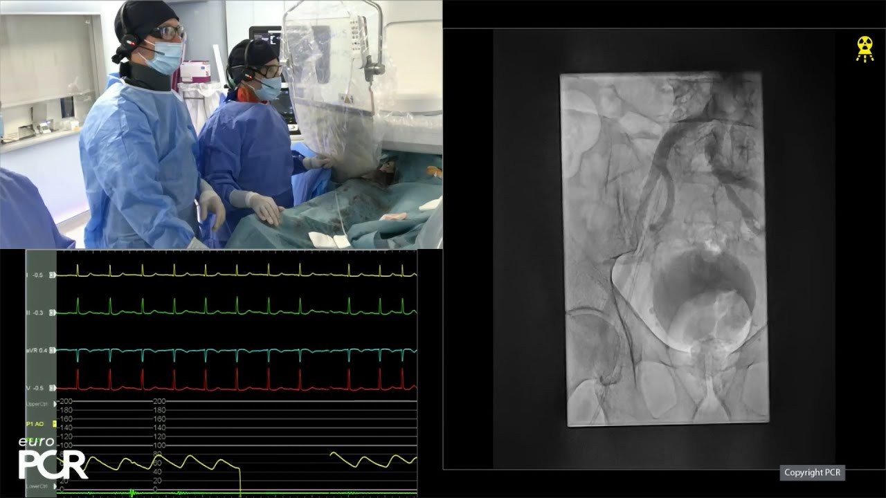 Myval Octapro THV - Optimise patient outcomes with novel design, data ...