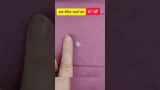 Oops जकट फट गई No Worry