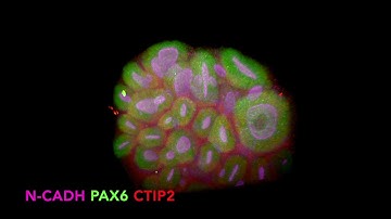 Lightsheet acquisition of a dorsal forebrain organoïd stained with N-CADH, PAX6 & CTIP2 antibodies.