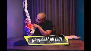 علاج ألام الظهر والأنزلاق الغضروفى  بدون جراحه