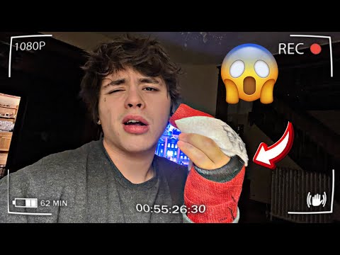 I broke my knuckle, send help (GOIN CRAZY)