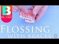 How to Floss with Braces (SuperFloss, Platypus, SoftPicks, etc)