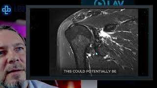 AI Real Time - Gemini 2.0 Flash Experimental model - Radiology