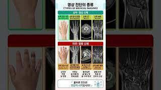 ​"골절은 X-ray, 인대는 MRI? 내 몸에 맞는 의료 영상 완전 정복"​ #영상진단 #CT #MRI #엑스레이 #MRI #골절 #디스크 #건강관리 #메디컬에듀 #내몸에맞는검사
