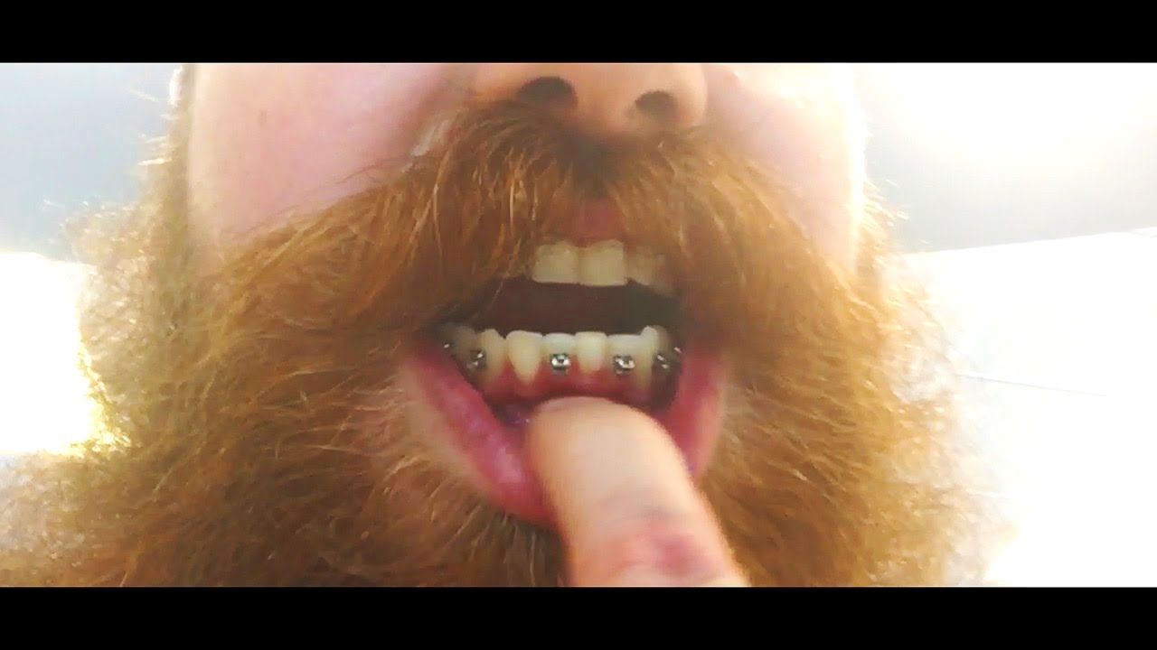 BRACES UPDATE & A LOST PACKAGE || Day 375 braceface baby