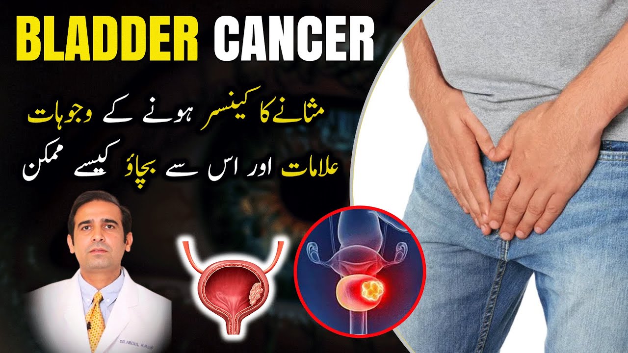 Bladder Cancer, Causes, Symptoms & Signs, Diagnosis and Treatment Urdu/Hindi