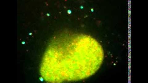 mRNA Being Translated in Living Cells