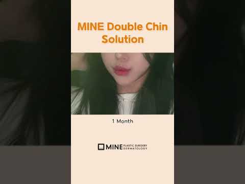 Just 1 hour ????????  #shorts #plasticsurgery #1hour