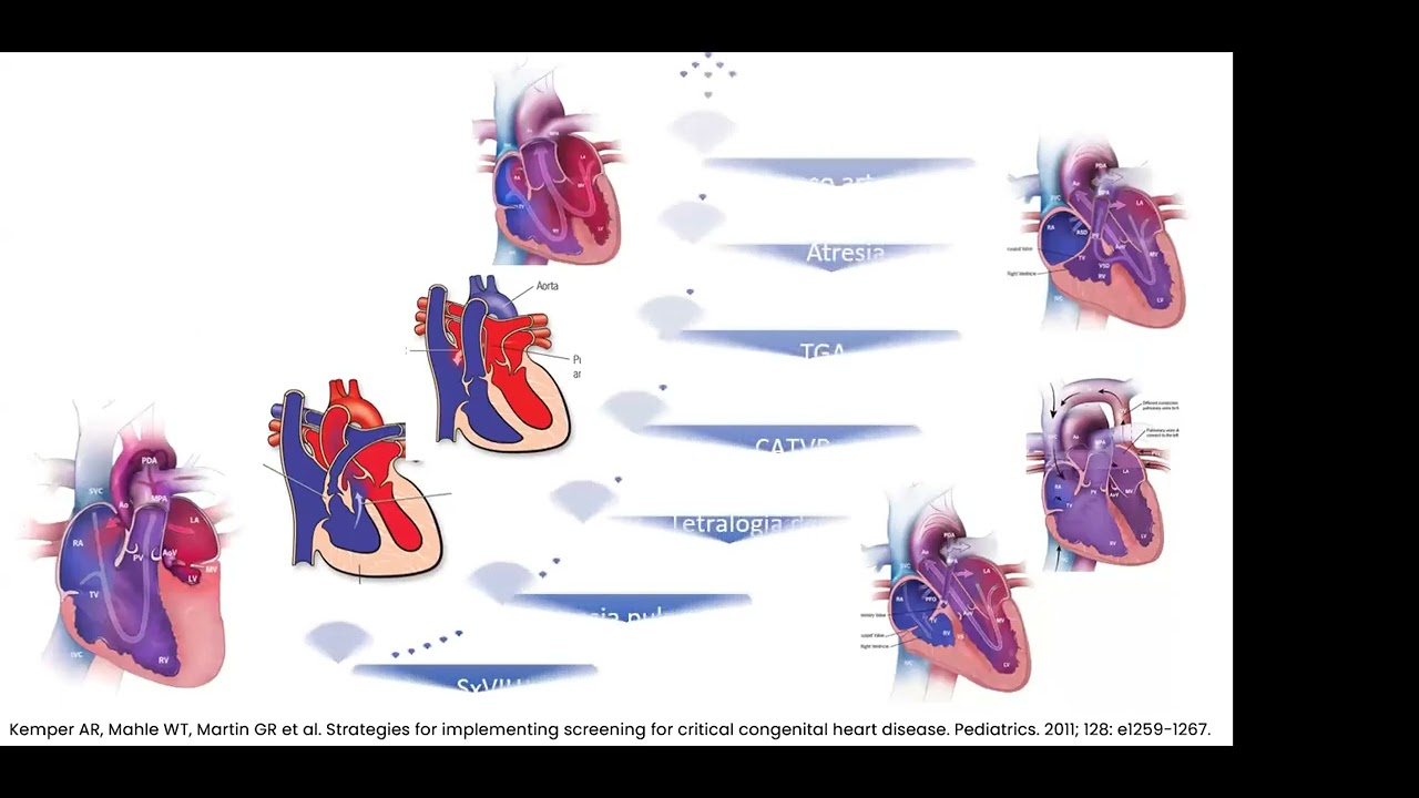 Novedades del Tamiz Cardiaco Neonatal