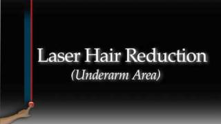Laser Hair Removal - Denovo Medical Group - Dallas