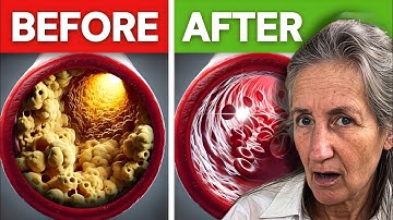 1 Best Meal to Prevent Heart Attack and Stroke by Barbara O’Neill