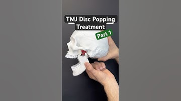 Part 1 of 2 - Fix TMJ disc popping. #tmj #tmd #tmjtreatment