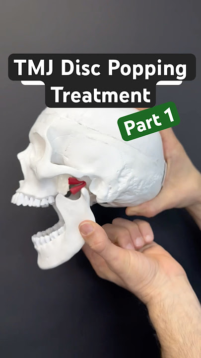 Part 1 of 2 - Fix TMJ disc popping. #tmj #tmd #tmjtreatment