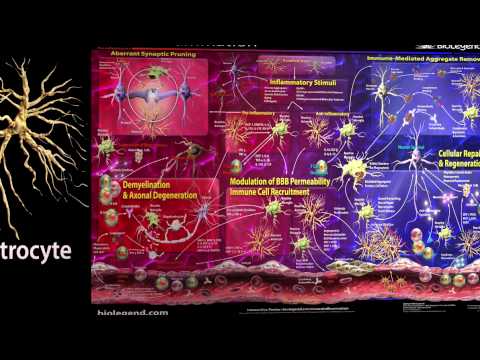 Sciatica with Herniated Disc? Best Way to Walk, Sit, Sleep, & Drive.. 