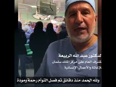 نجاح عملية فصل التوأم اليمني مودة ورحمة في السعودية السعودية 