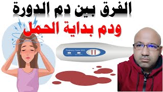 الفرق بين دم الحيض وبين دم بداية الحمل الافرازات البنية قبل الدورة الشهرية  نزول دم بني قبل الدورة