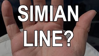 Celebrity What are Simian Lines & Do You Have Them? Net Worth