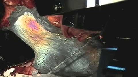 Biomechanics: Visualizing stress & strain in a human hip joint with photoelasticity