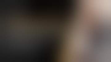 Laparoscopic Left Hepatectomy- Step by Step by Dr Sandeep Nayak & team