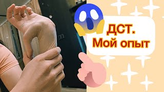 Дисплазия соединительной ткани | про мои симптомы  | личный мой опыт