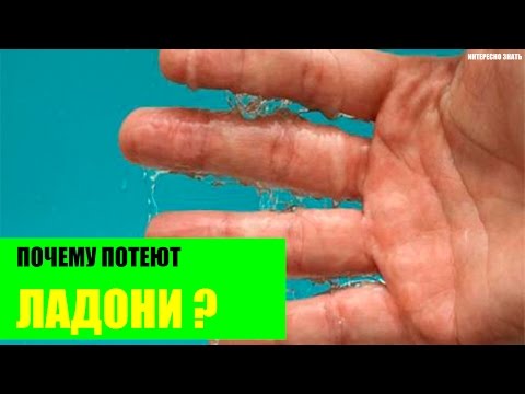 Почему потеют ладони?