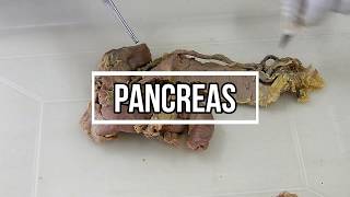 Pancreas - gross anatomy