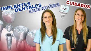 CUIDADOS después de la colocación de IMPLANTES DENTALES con o sin INJERTOS ÓSEOS / QUÉ COMER?