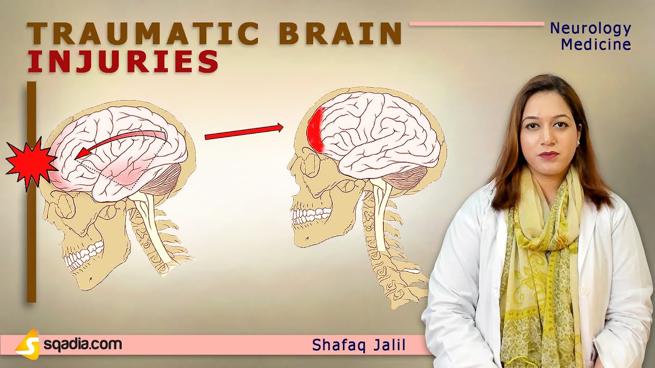 Traumatic Brain Injuries | Introduction | Neurology Lectures | Medical Online | V-Learning