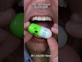 Satisfying Chewing ASMR #Compilation #ASMR #DoctorTristanPeh